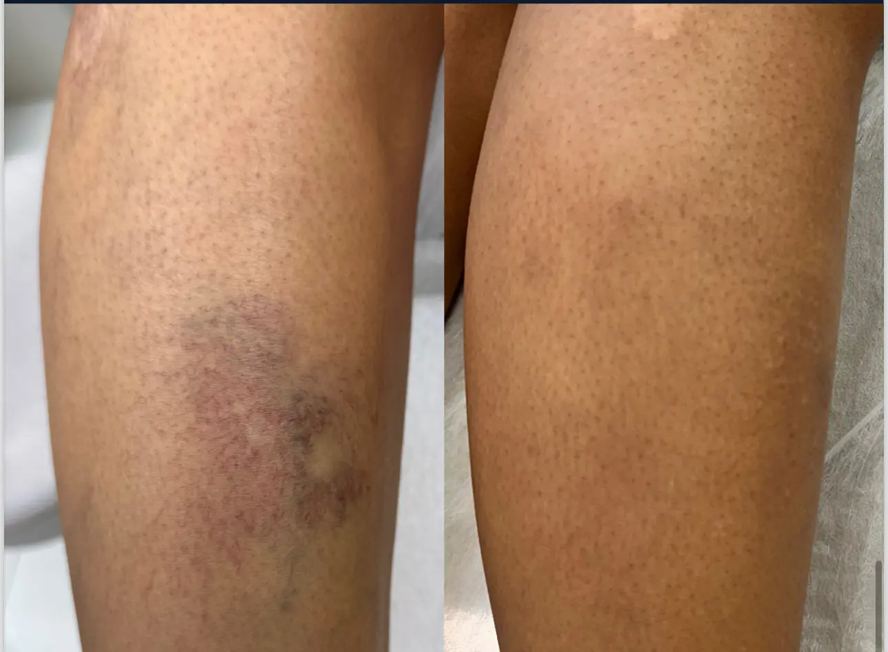 Resultado de Tratamento