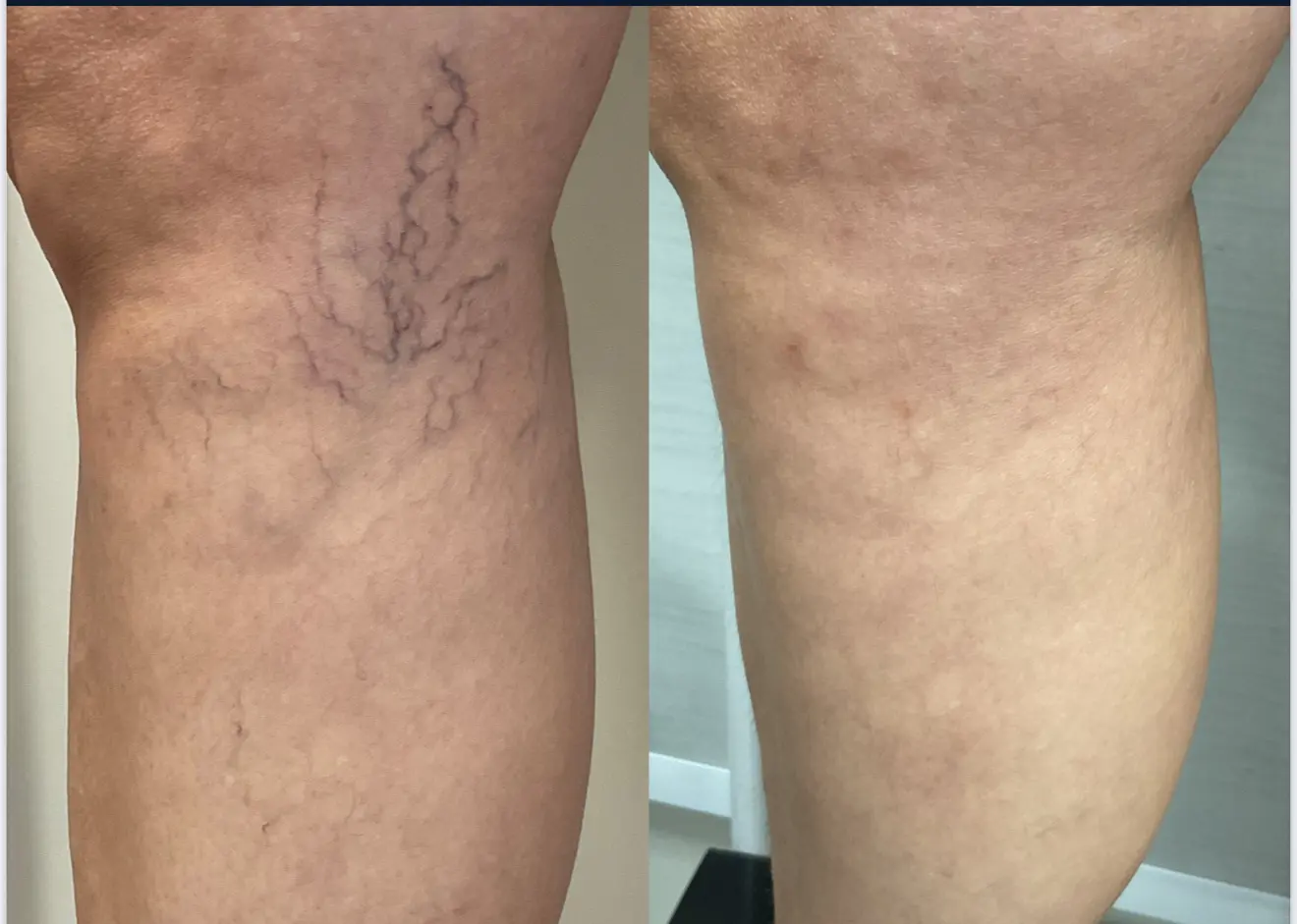 Resultado de Tratamento